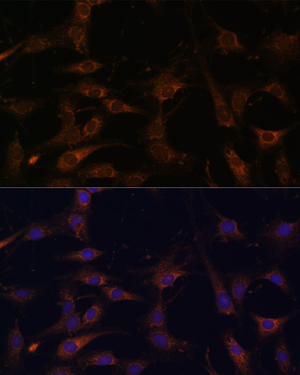 Immunofluorescence analysis of C6 cells using RAB21 Polyclonal Antibody at dilution of  1:100. Blue: DAPI for nuclear staining.