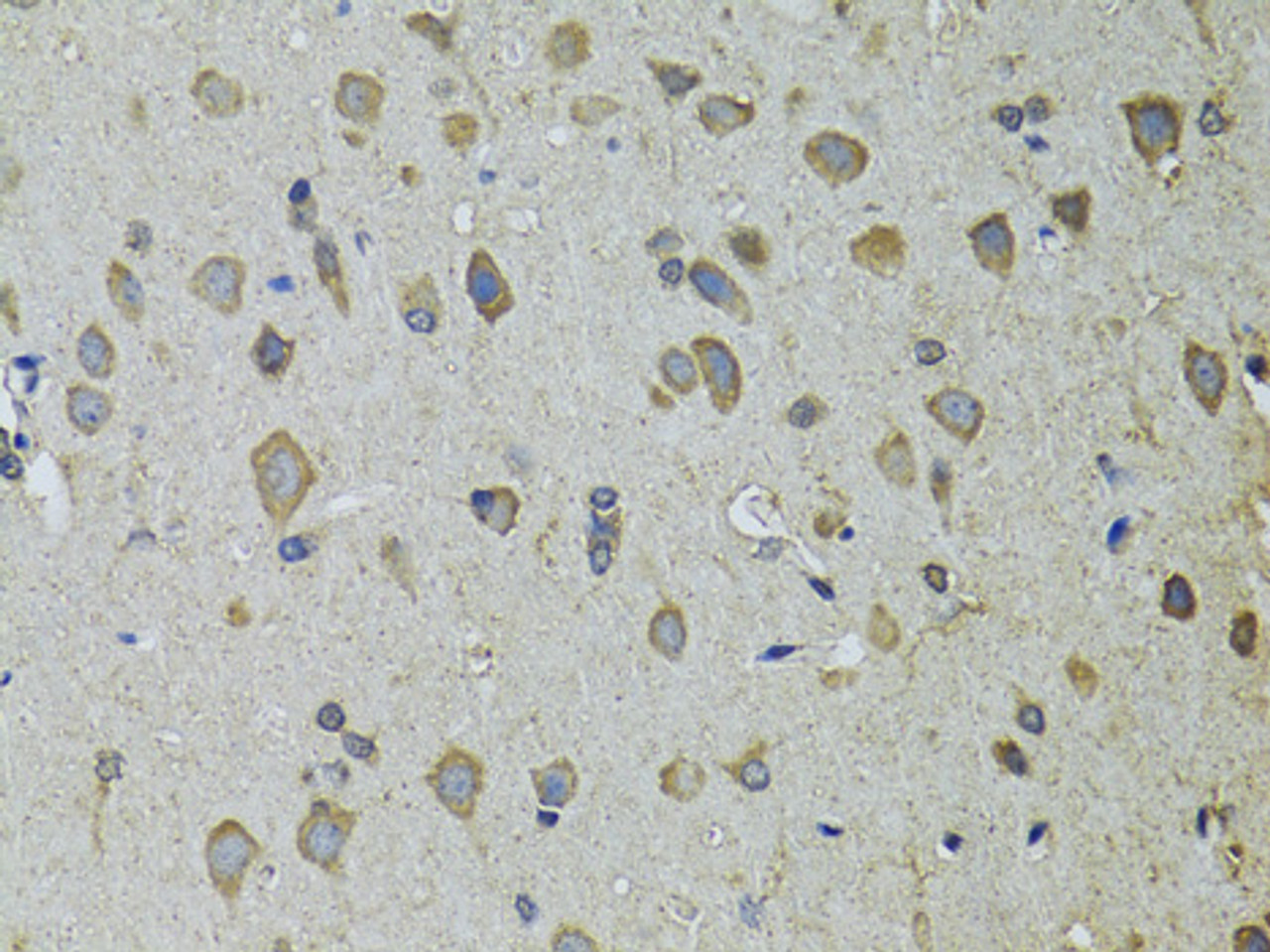 Immunohistochemistry of paraffin-embedded Rat brain using UGDH Polyclonal Antibody at dilution of  1:100 (40x lens).