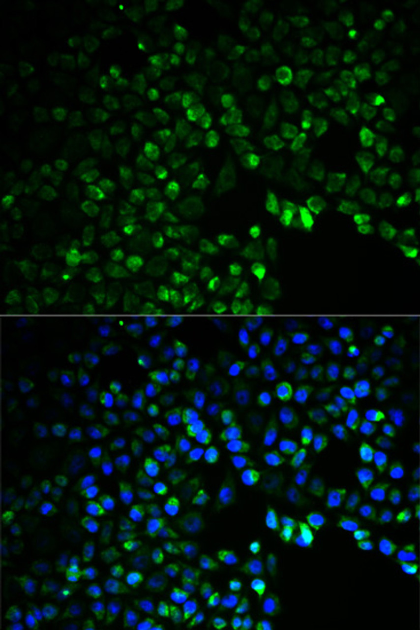 Immunofluorescence analysis of HeLa cells using UGDH Polyclonal Antibody