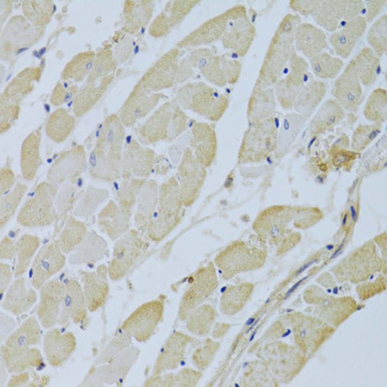 Immunohistochemistry of paraffin-embedded Rat heart using CA3 Polyclonal Antibody at dilution of  1:200 (40x lens).