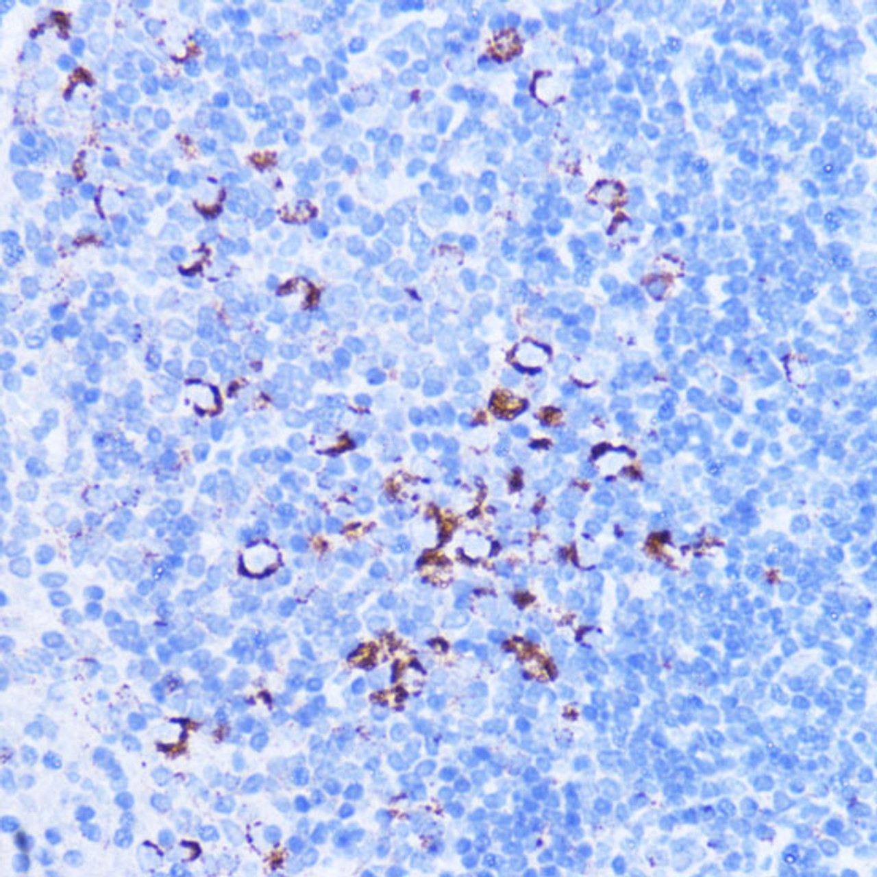 Immunohistochemistry of paraffin-embedded Mouse spleen using SHMT2 Polyclonal Antibody at dilution of  1:100 (40x lens).