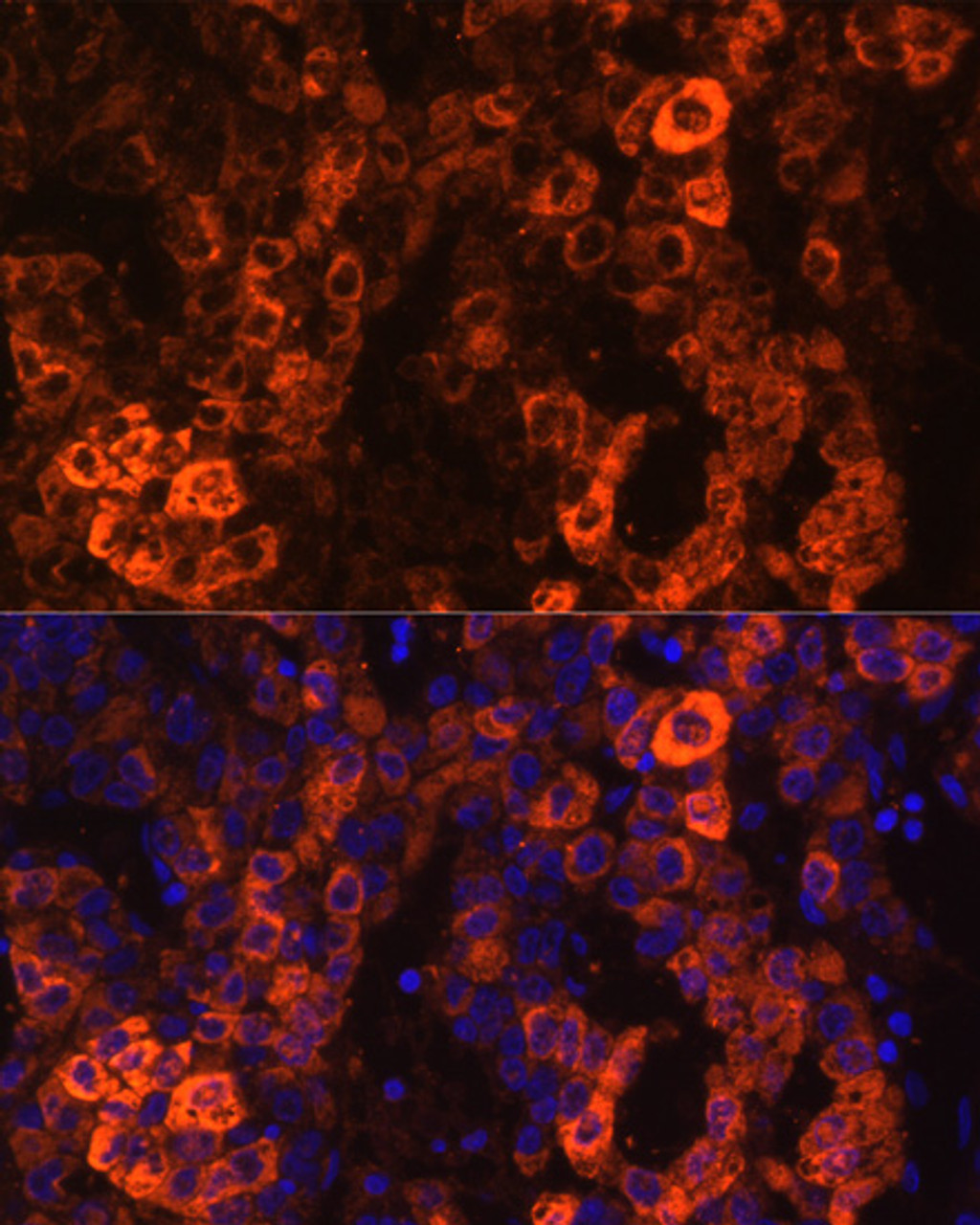 Immunofluorescence analysis of Human liver cancer cells using BHMT Polyclonal Antibody at dilution of  1:100. Blue: DAPI for nuclear staining.