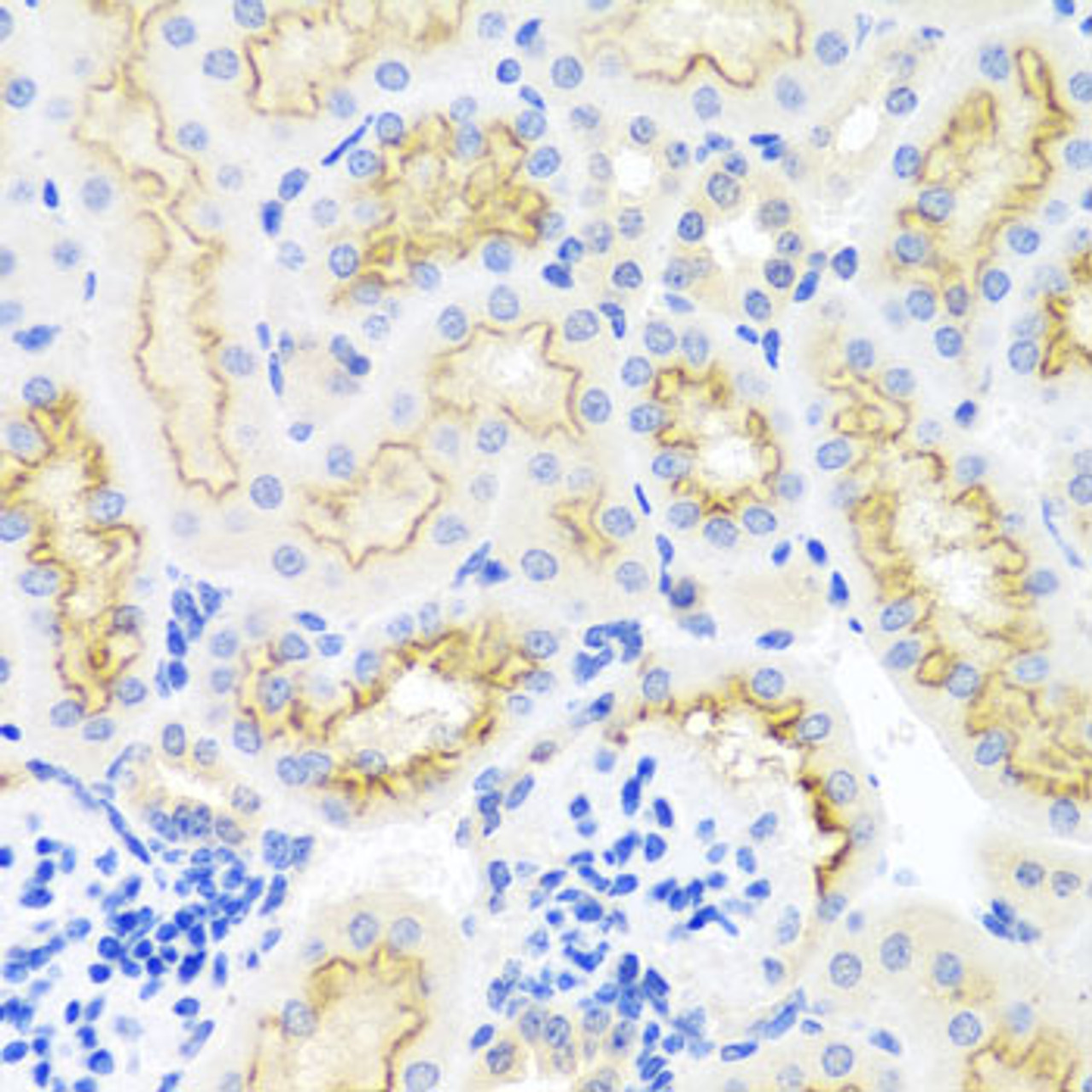 Immunohistochemistry of paraffin-embedded Mouse kidney using SRPX Polyclonal Antibody at dilution of  1:100 (40x lens).