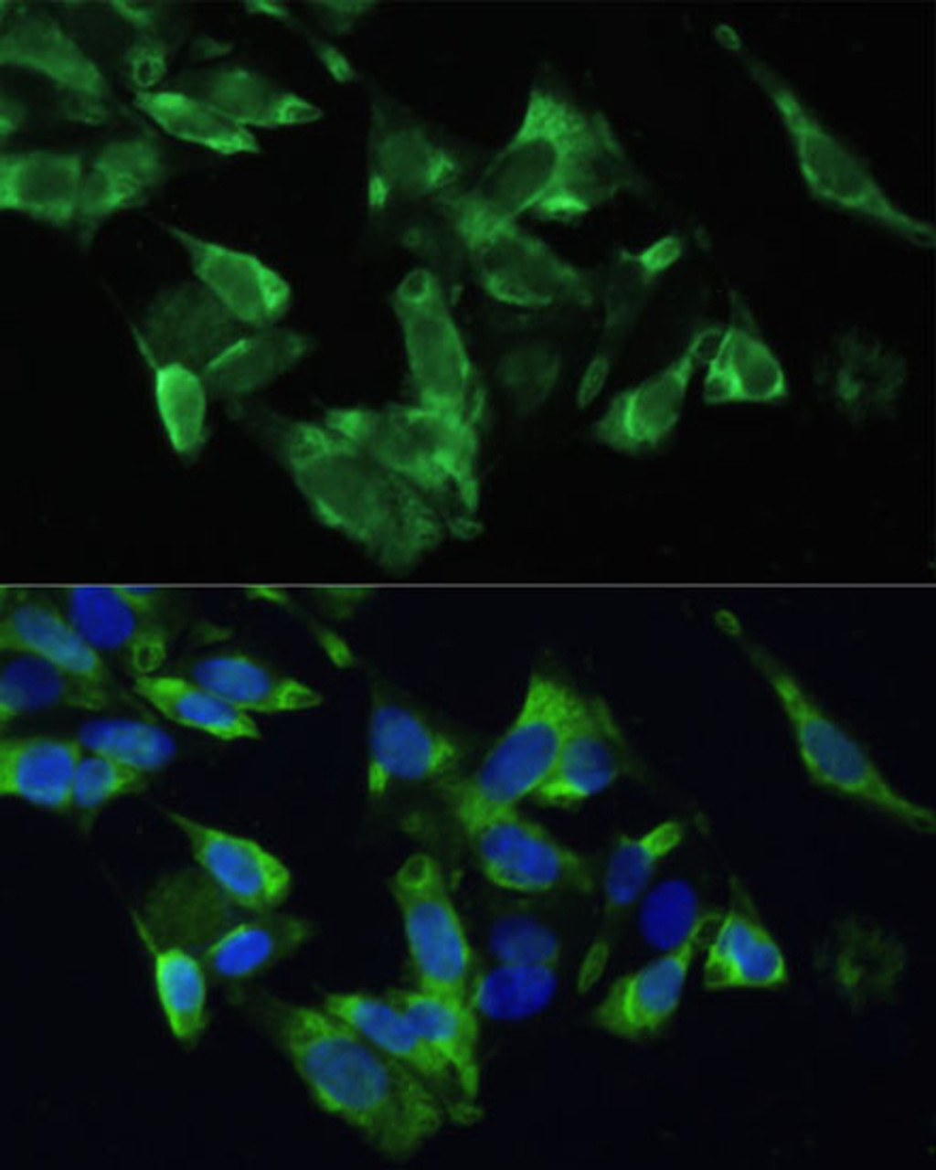 Immunofluorescence analysis of U2OS cells using PMEPA1 Polyclonal Antibody at dilution of  1:100. Blue: DAPI for nuclear staining.