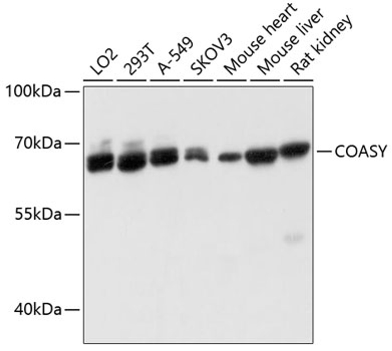 Western blot analysis of extracts of various cell lines using COASY Polyclonal Antibody at dilution of 1:3000.