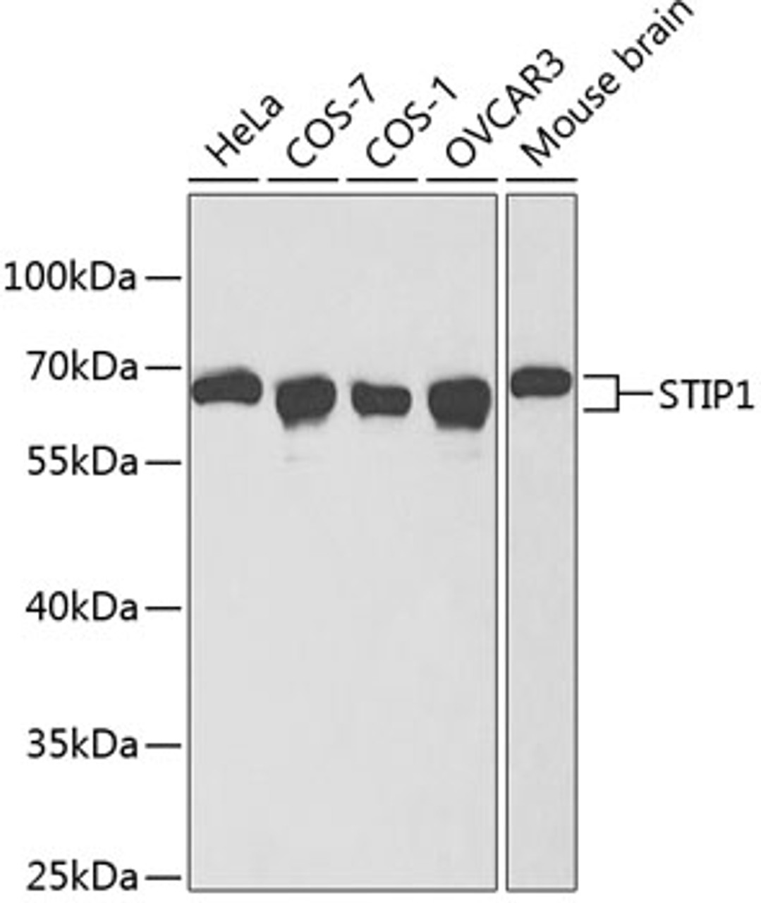 Western blot analysis of extracts of various cell lines using STIP1 Polyclonal Antibody at dilution of 1:1000.