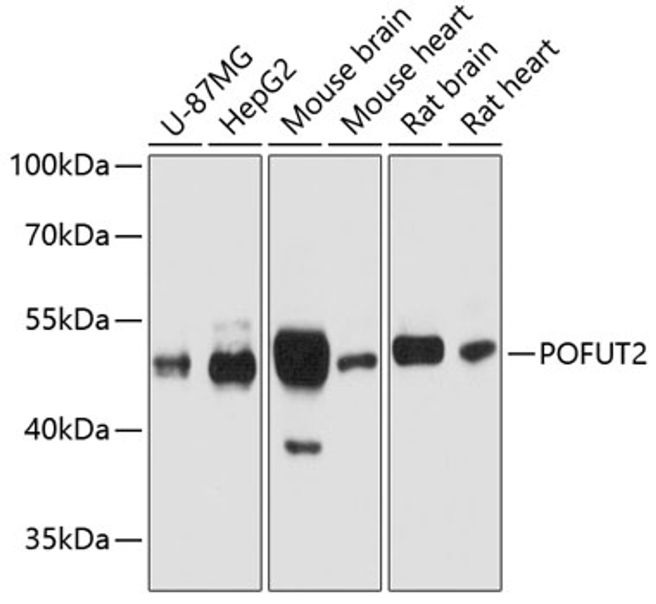 Western blot analysis of extracts of various cell lines using POFUT2 Polyclonal Antibody at dilution of 1:1000.