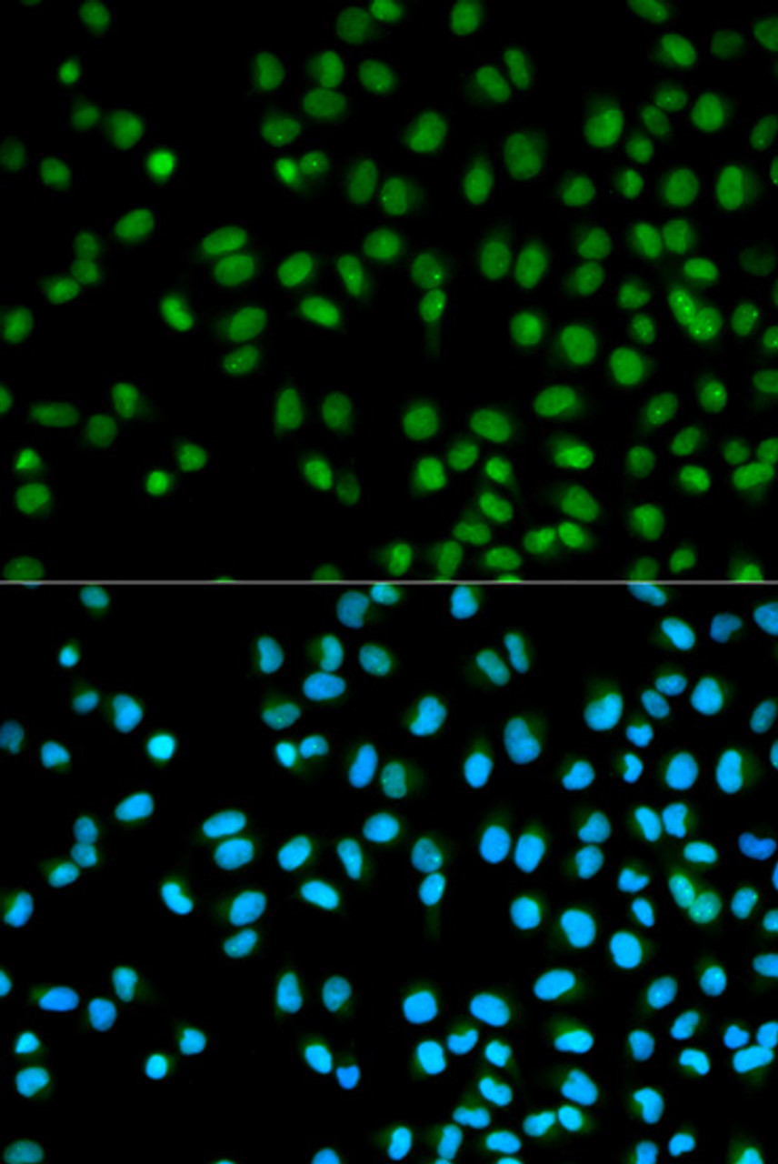 Immunofluorescence analysis of HeLa cells using CST8 Polyclonal Antibody