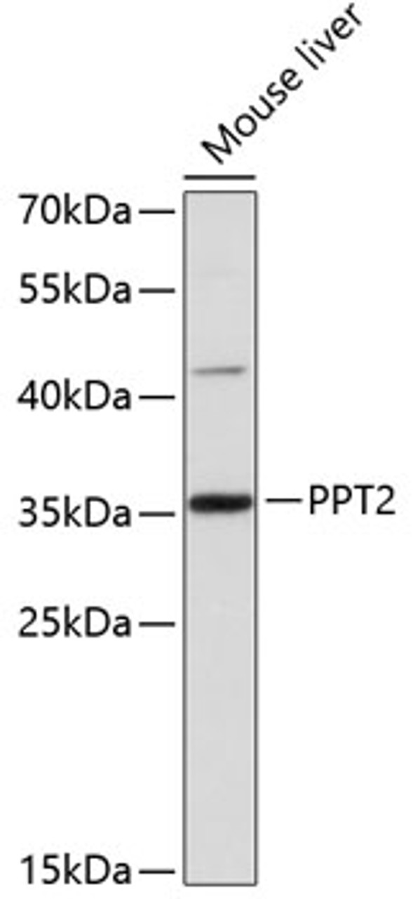 Western blot analysis of extracts of Mouse liver using PPT2 Polyclonal Antibody at dilution of 1:3000.