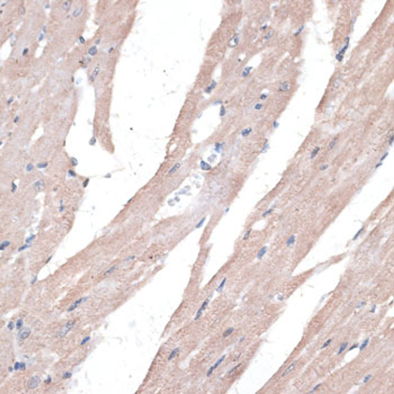 Immunohistochemistry of paraffin-embedded Mouse heart using PPT2 Polyclonal Antibody at dilution of  1:100 (40x lens).