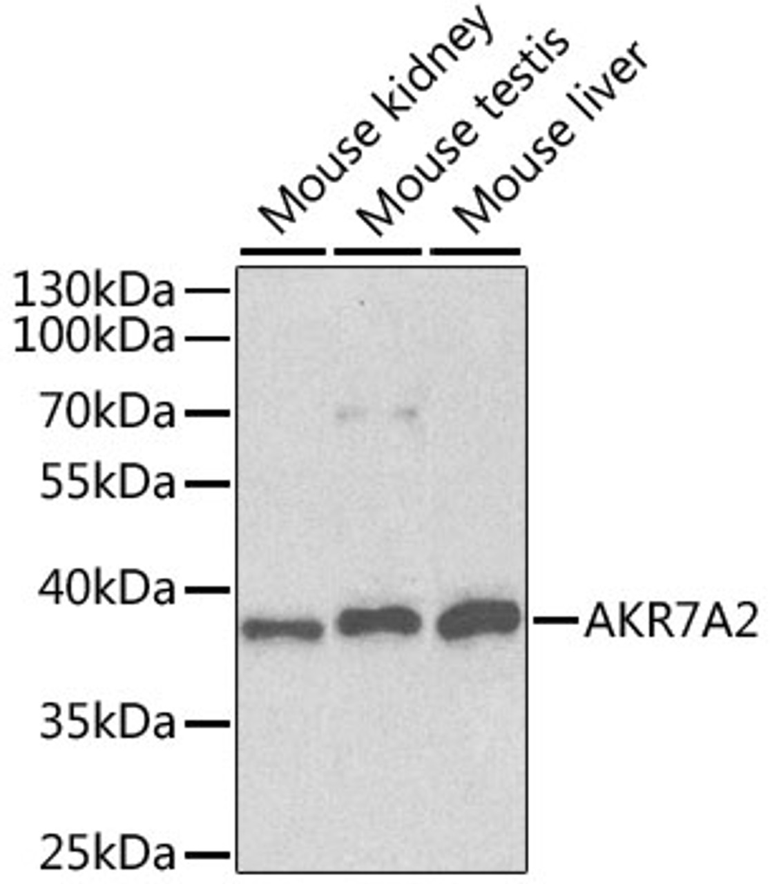 Western blot analysis of extracts of various cell lines using AKR7A2 Polyclonal Antibody at dilution of 1:1000.
