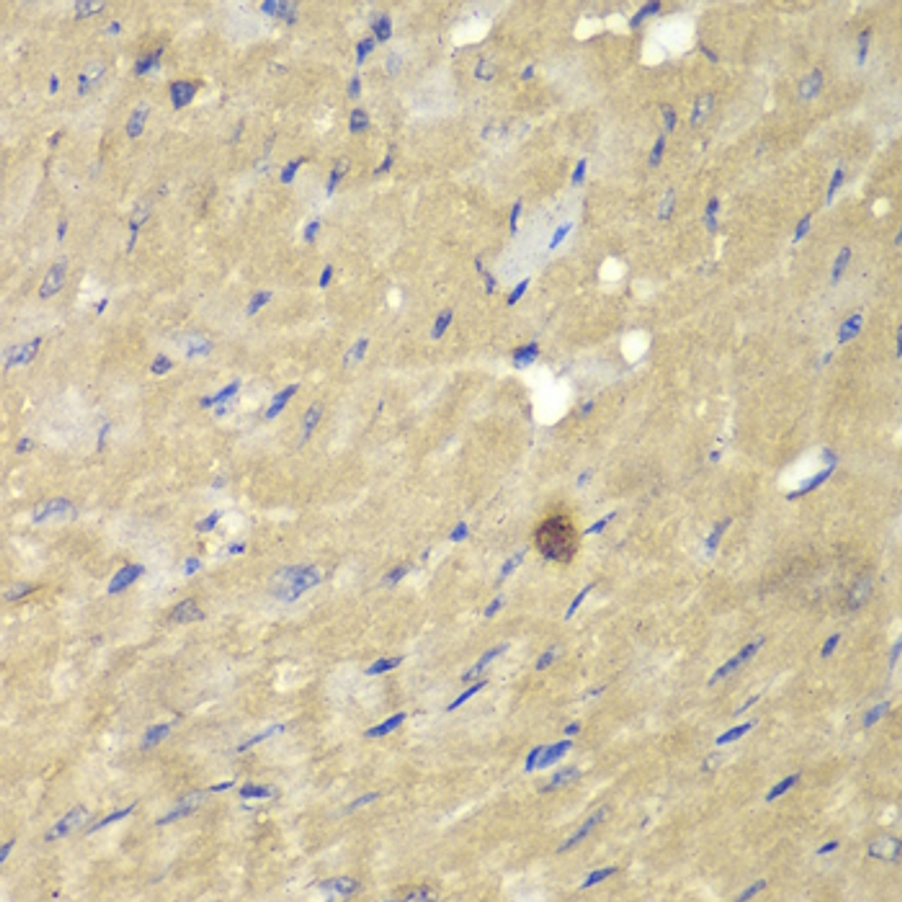 Immunohistochemistry of paraffin-embedded Mouse heart using AKR7A2 Polyclonal Antibody at dilution of  1:100 (40x lens).
