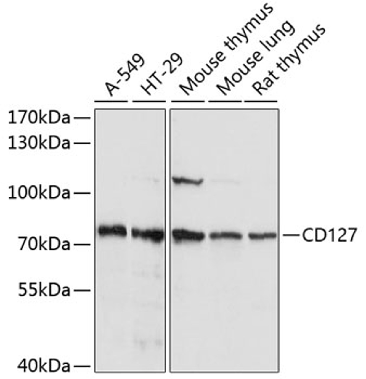 Western blot analysis of extracts of various cell lines using CD127 Polyclonal Antibody at dilution of 1:1000.