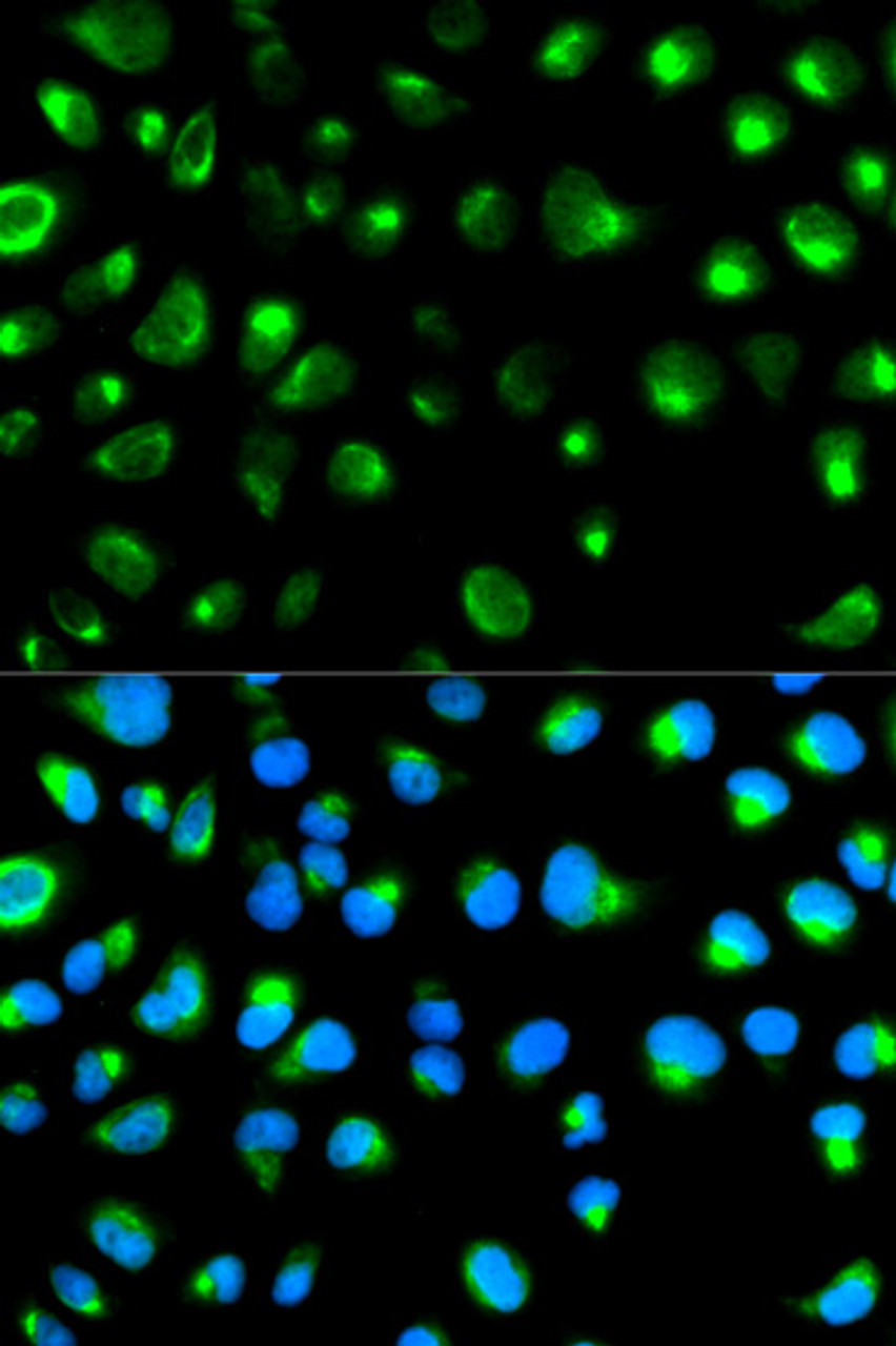 Immunofluorescence analysis of MCF-7 cells using GYPC Polyclonal Antibody
