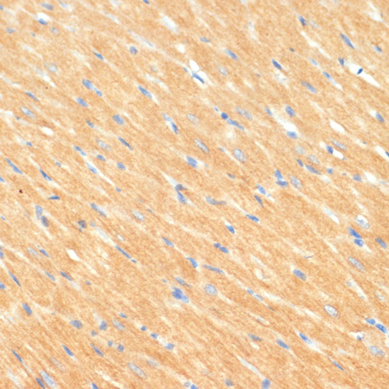 Immunohistochemistry of paraffin-embedded Rat heart using MYBPC3 Polyclonal Antibody at dilution of  1:100 (40x lens).
