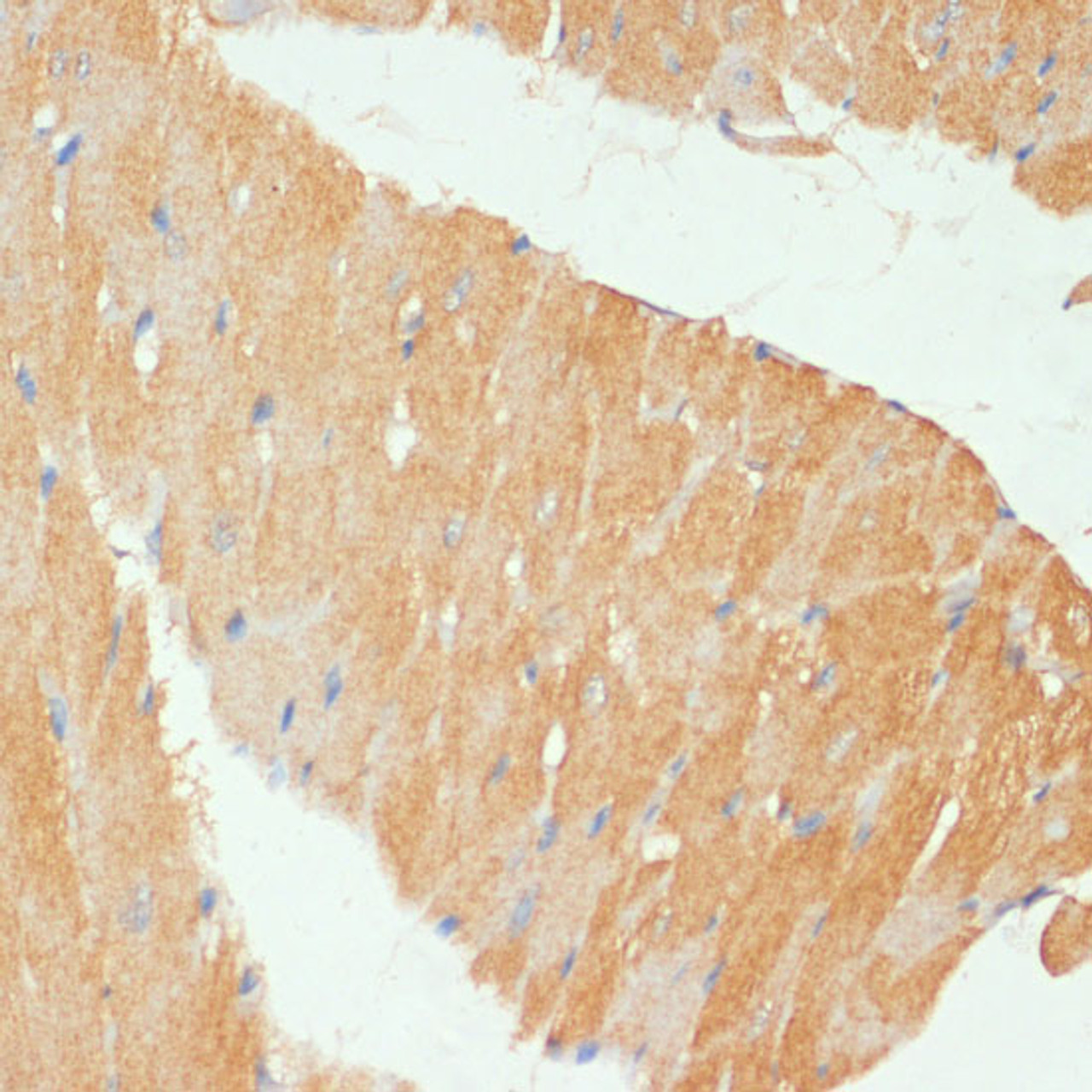 Immunohistochemistry of paraffin-embedded Mouse heart using MYBPC3 Polyclonal Antibody at dilution of  1:100 (40x lens).