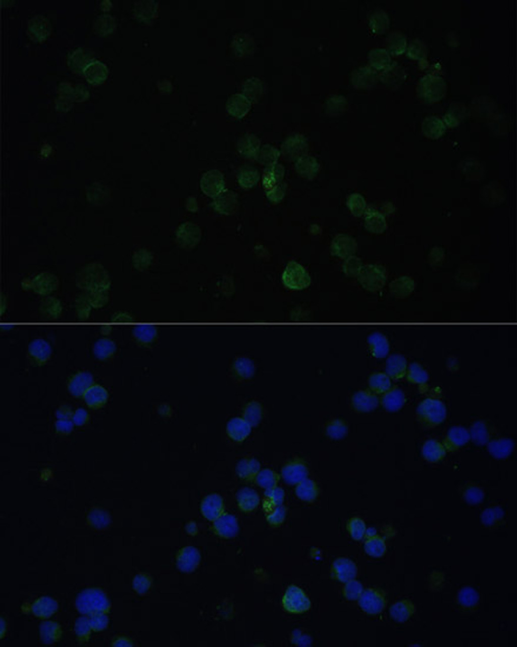 Immunofluorescence analysis of Jurkat cells using CD3D Polyclonal Antibody at dilution of  1:100. Blue: DAPI for nuclear staining.