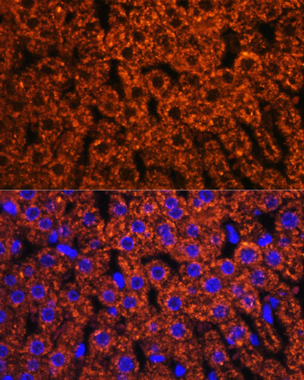 Immunofluorescence analysis of Rat liver using F2 Polyclonal Antibody at dilution of  1:100. Blue: DAPI for nuclear staining.