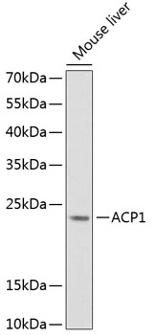 Western blot analysis of extracts of Mouse liver using ACP1 Polyclonal Antibody at dilution of 1:1000.