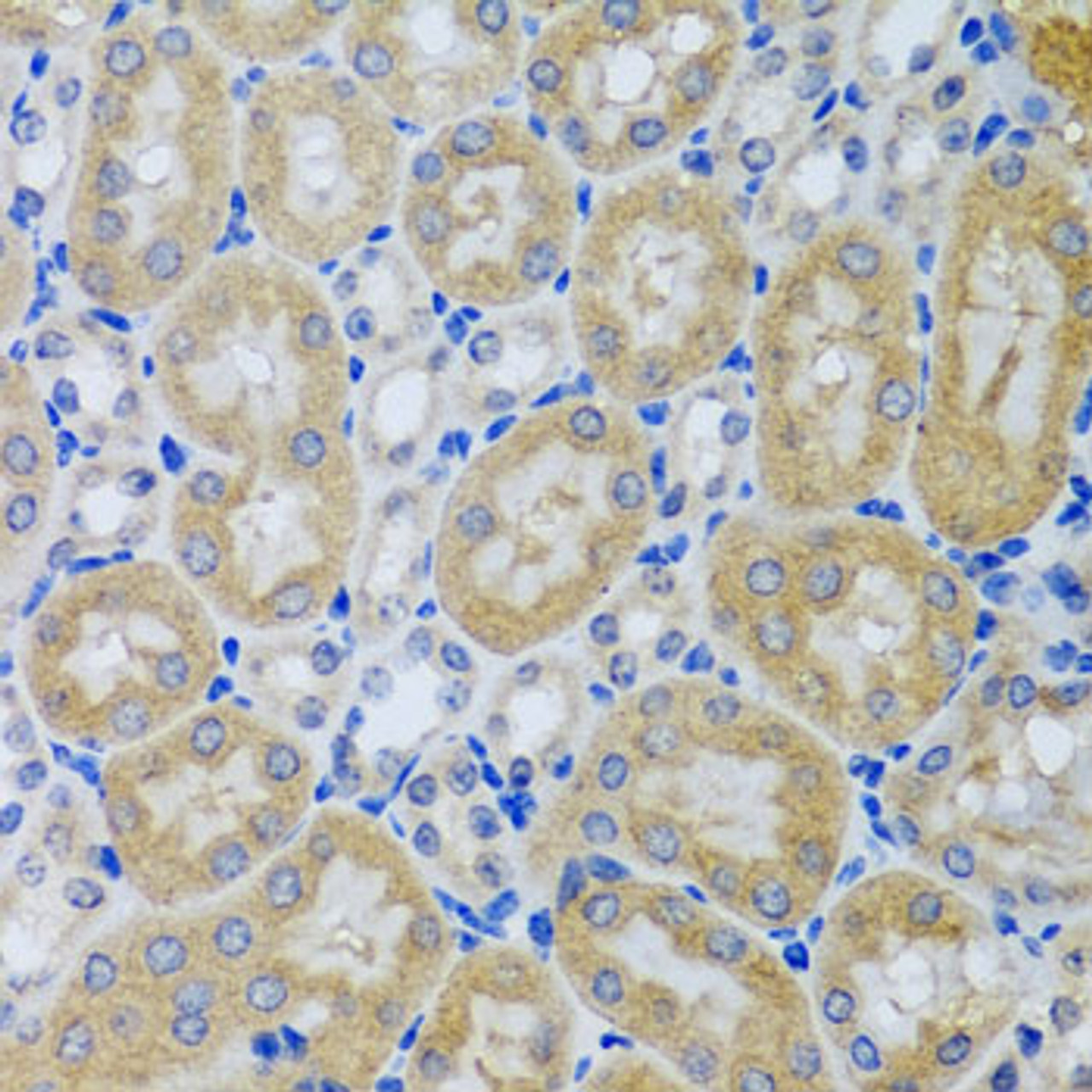 Immunohistochemistry of paraffin-embedded Mouse kidney using ACP1 Polyclonal Antibody at dilution of  1:100 (40x lens).