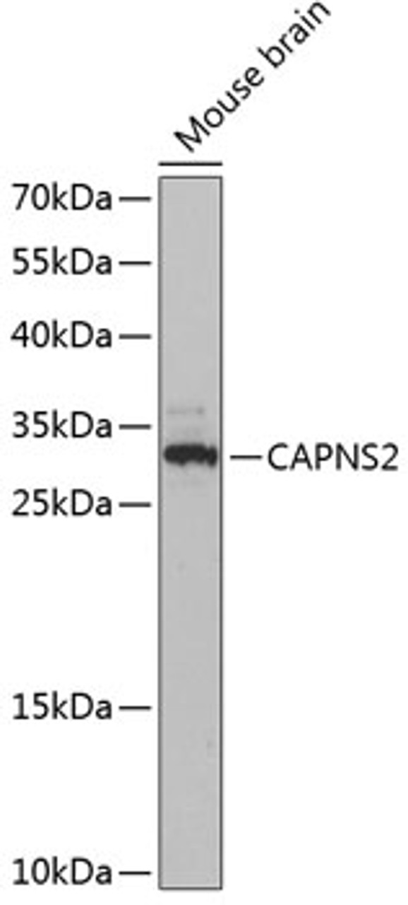 Western blot analysis of extracts of Mouse brain using CAPNS2 Polyclonal Antibody at dilution of 1:3000.