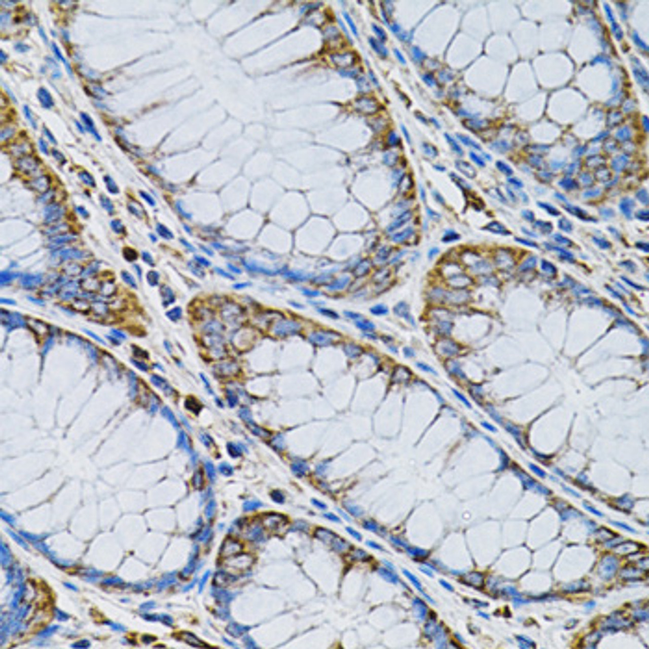 Immunohistochemistry of paraffin-embedded Human colon using ADSS Polyclonal Antibody at dilution of  1:100 (40x lens).