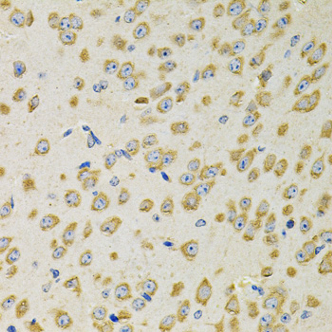 Immunohistochemistry of paraffin-embedded Mouse brain using ADSS Polyclonal Antibody at dilution of  1:100 (40x lens).
