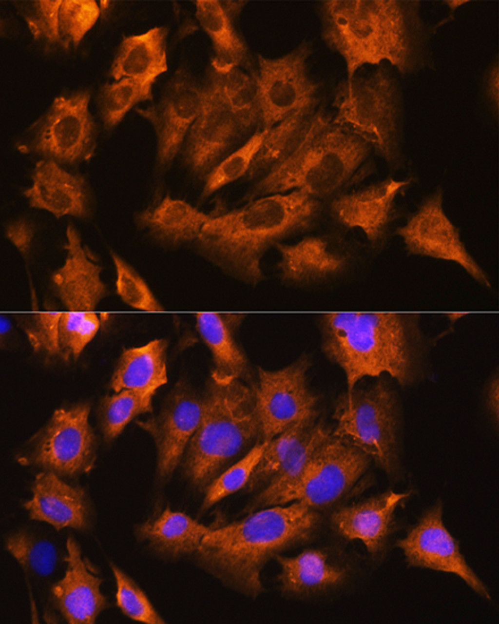 Immunofluorescence analysis of C6 cells using ATP1B1 Polyclonal Antibody at dilution of  1:100. Blue: DAPI for nuclear staining.