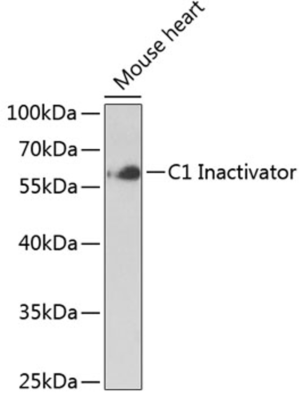 Western blot analysis of extracts of Mouse heart using C1 Inactivator Polyclonal Antibody at dilution of 1:1000.