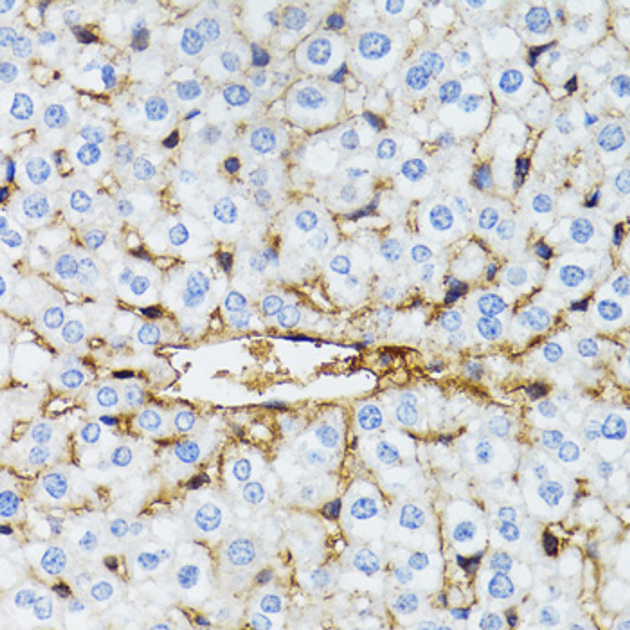 Immunohistochemistry of paraffin-embedded Mouse liver using C1 Inactivator Polyclonal Antibody at dilution of  1:100 (40x lens).