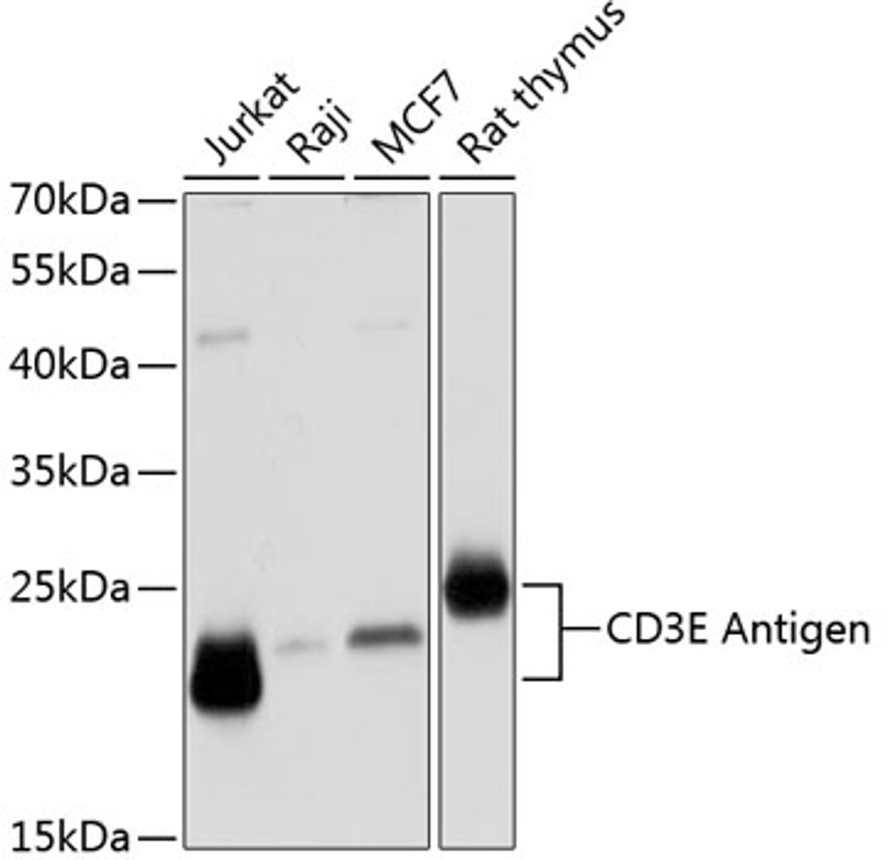 Western blot analysis of extracts of various cell lines using CD3E Antigen Polyclonal Antibody at dilution of 1:1000.