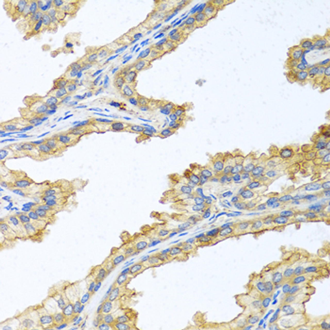 Immunohistochemistry of paraffin-embedded Human prostate using PRSS1 Polyclonal Antibody at dilution of  1:100 (40x lens).