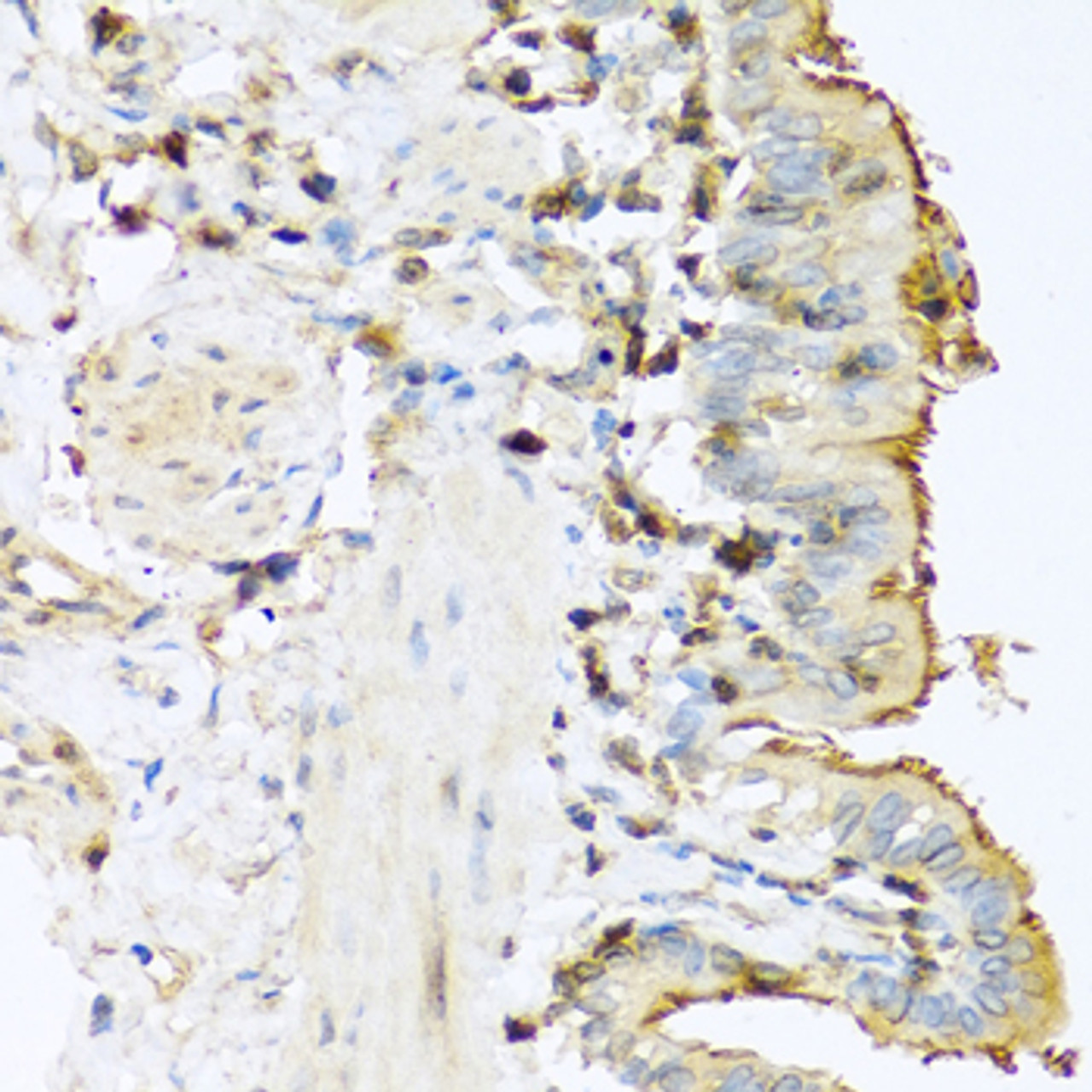 Immunohistochemistry of paraffin-embedded Mouse lung using PRSS1 Polyclonal Antibody at dilution of  1:100 (40x lens).