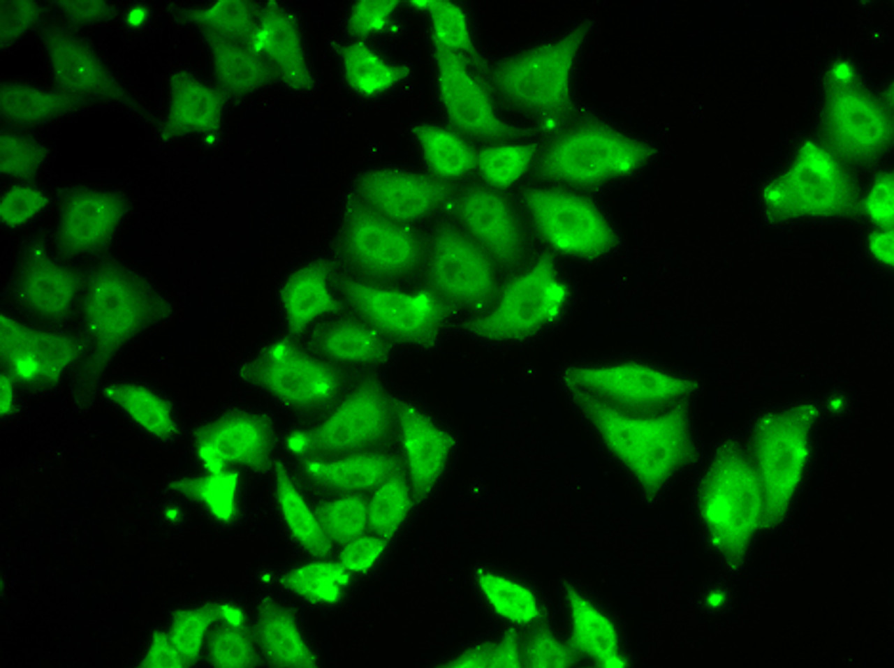 Immunofluorescence analysis of HeLa cells using Ataxin 3 Polyclonal Antibody