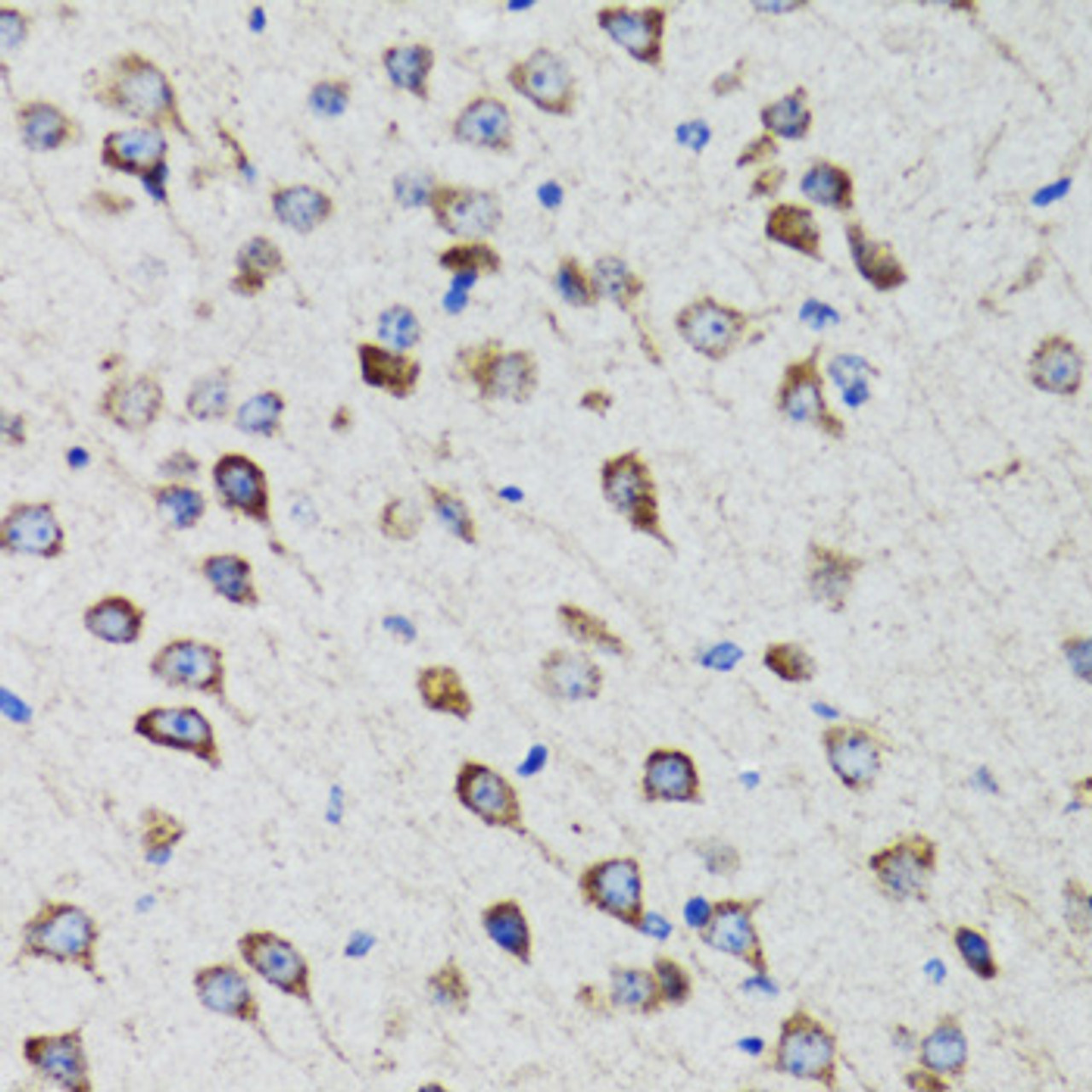 Immunohistochemistry of paraffin-embedded Rat brain using HEXA Polyclonal Antibody at dilution of  1:100 (40x lens).