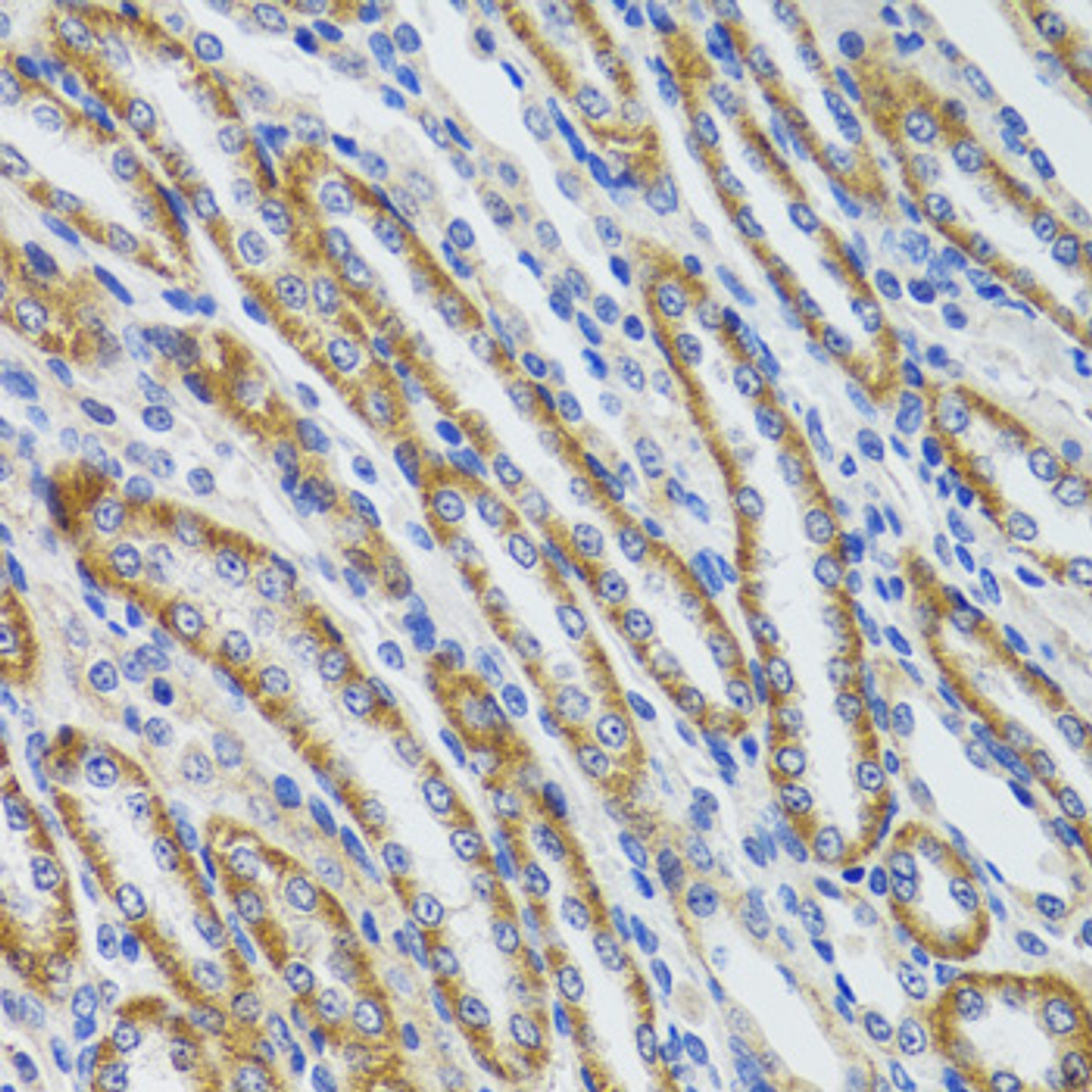 Immunohistochemistry of paraffin-embedded Mouse kidney using HEXA Polyclonal Antibody at dilution of  1:100 (40x lens).