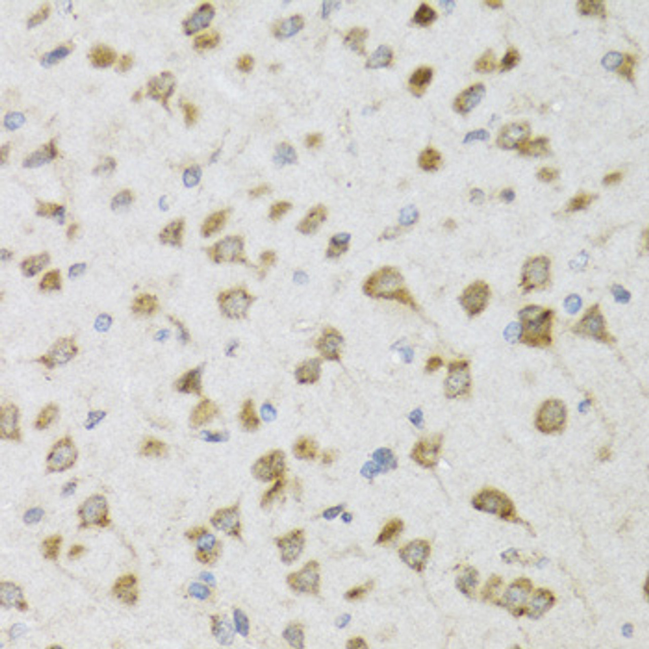 Immunohistochemistry of paraffin-embedded Rat brain using PI3 Polyclonal Antibody at dilution of  1:100 (40x lens).