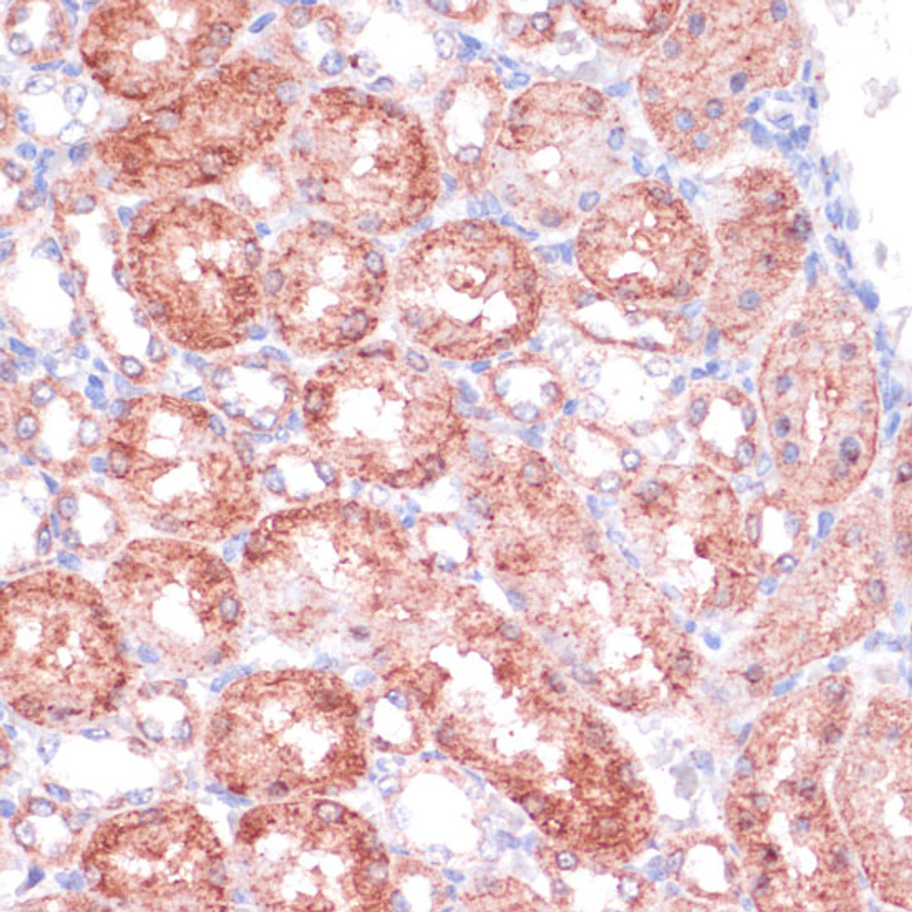 Immunohistochemistry of paraffin-embedded Rat kidney using SHMT1 Polyclonal Antibody at dilution of  1:100 (40x lens).