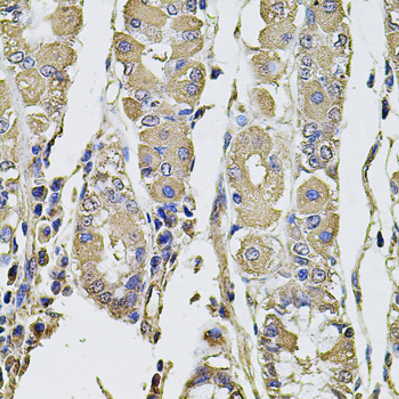 Immunohistochemistry of paraffin-embedded Human stomach using PTHLH Polyclonal Antibody at dilution of  1:100 (40x lens).