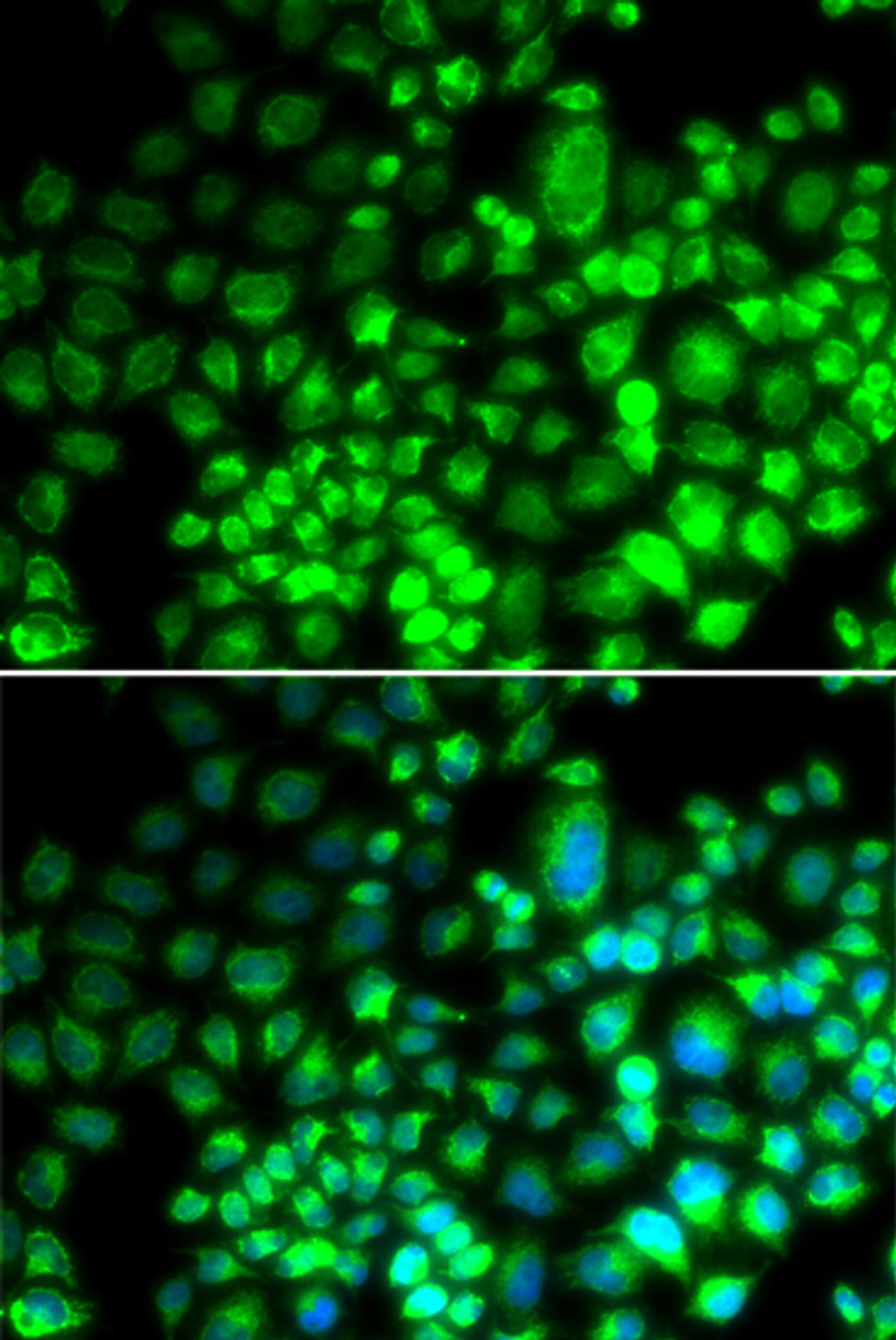 Immunofluorescence analysis of HeLa cells using ST6GAL1 Polyclonal Antibody