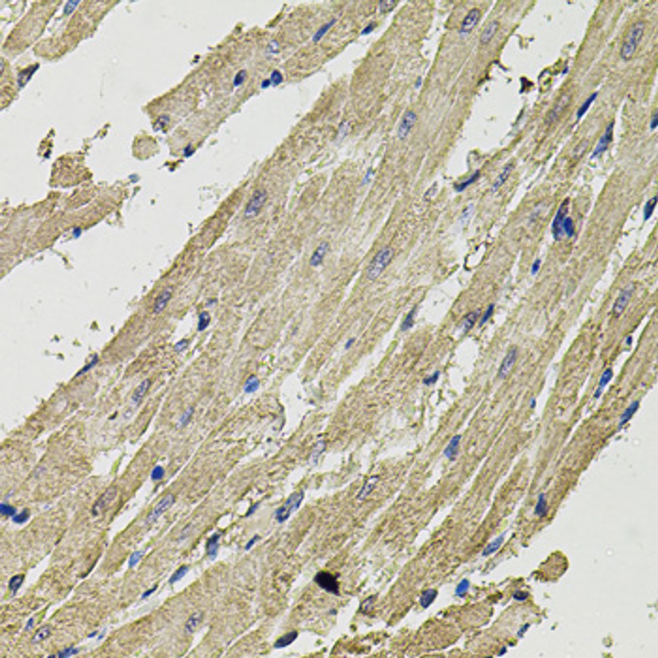 Immunohistochemistry of paraffin-embedded Rat heart using SMN2 Polyclonal Antibody