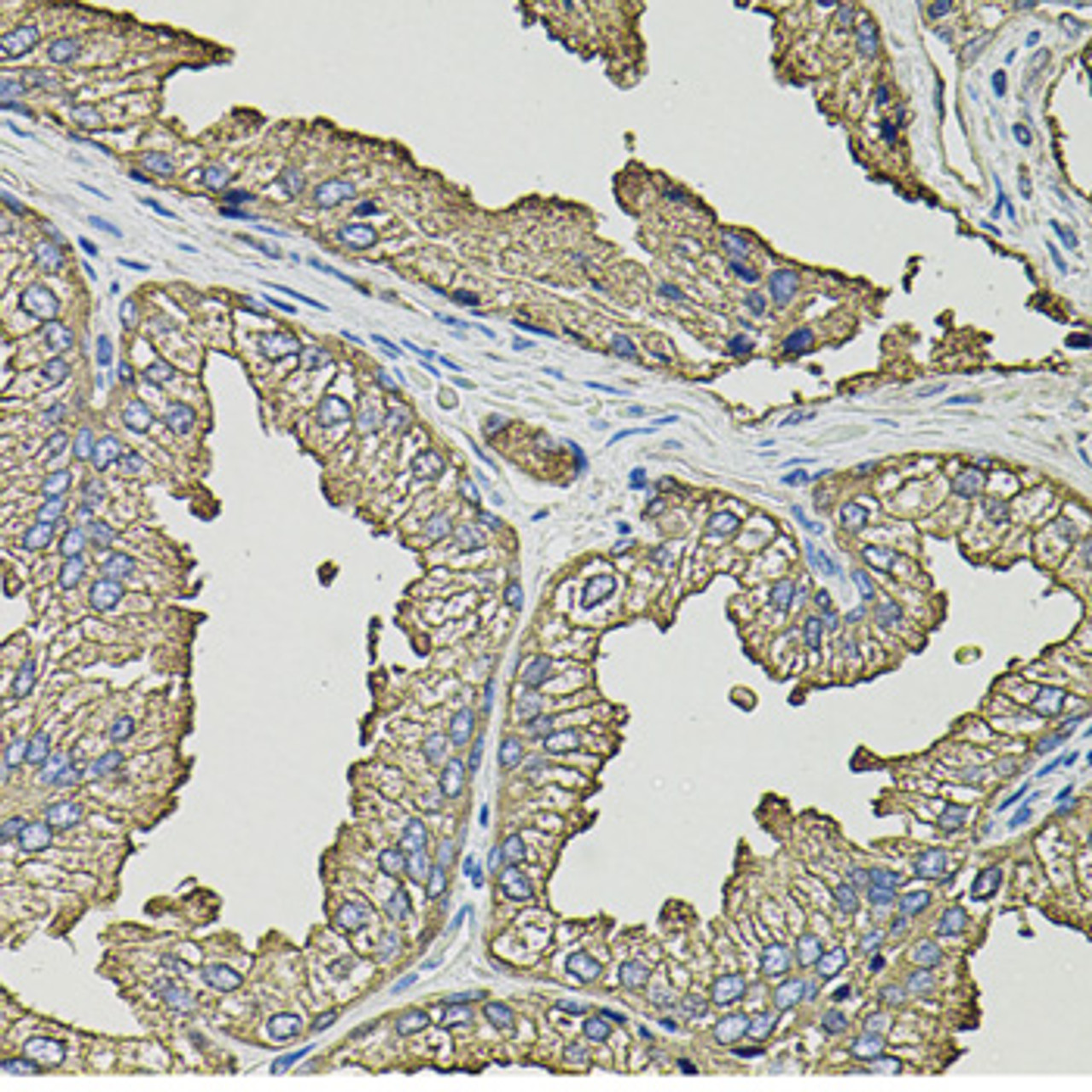 Immunohistochemistry of paraffin-embedded Human prostate using SMN2 Polyclonal Antibody