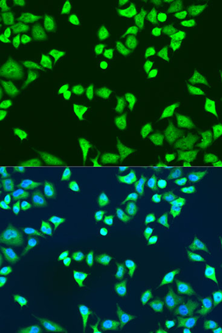 Immunofluorescence analysis of U2OS cells using SMN2 Polyclonal Antibody at dilution of  1:100. Blue: DAPI for nuclear staining.