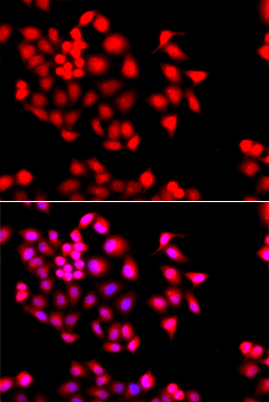 Immunofluorescence analysis of A549 cells using STXBP2 Polyclonal Antibody