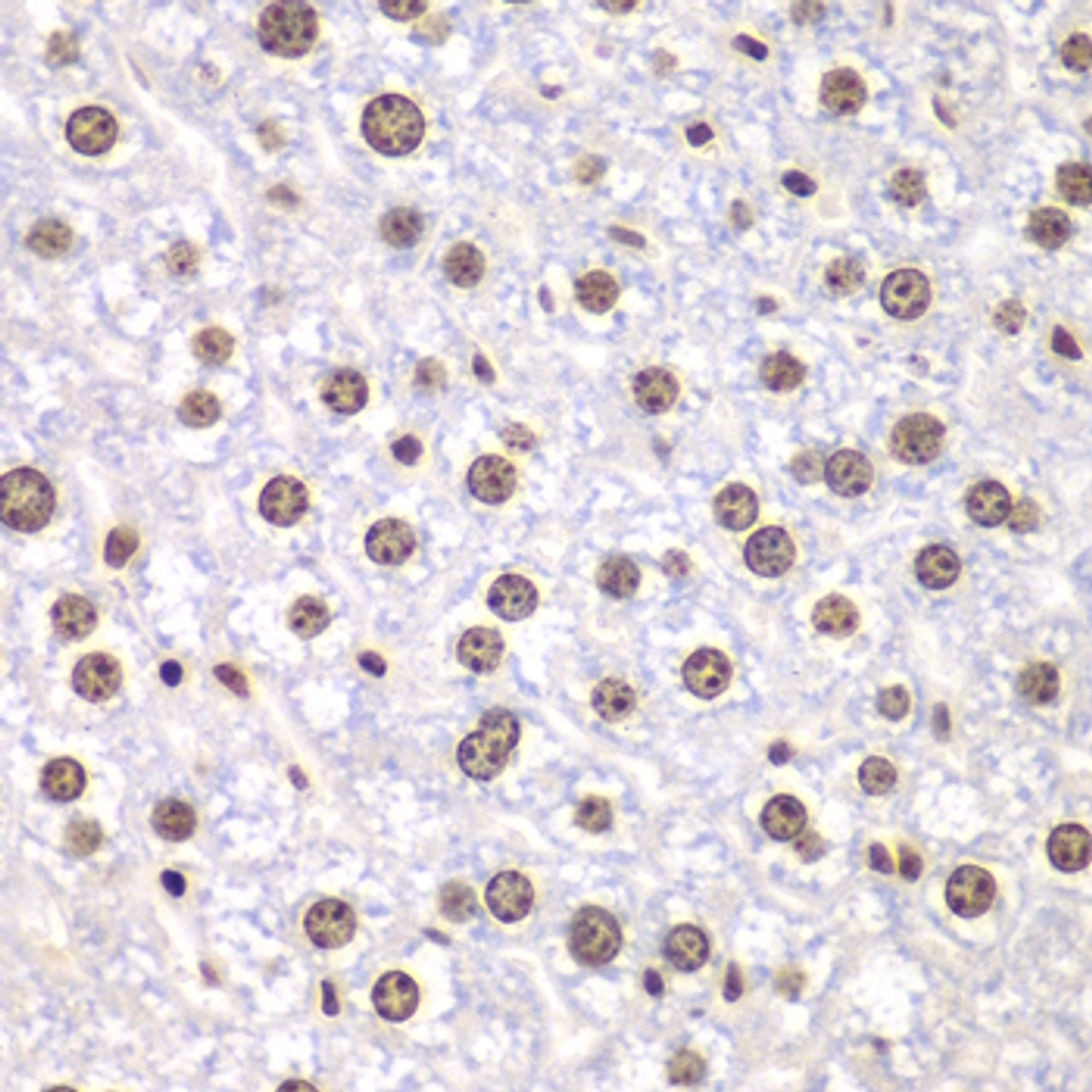 Immunohistochemistry of paraffin-embedded Mouse liver using TOP1 Polyclonal Antibody at dilution of  1:100 (40x lens).