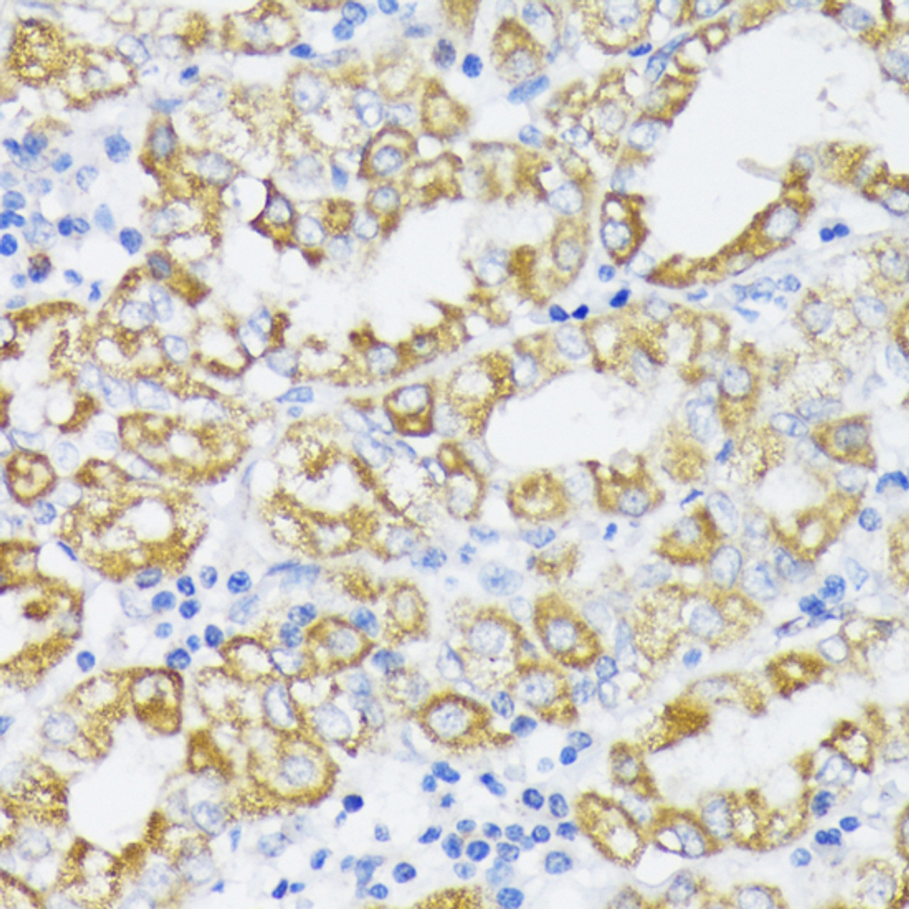 Immunohistochemistry of paraffin-embedded Human stomach using SLC30A1 Polyclonal Antibody at dilution of  1:100 (40x lens).