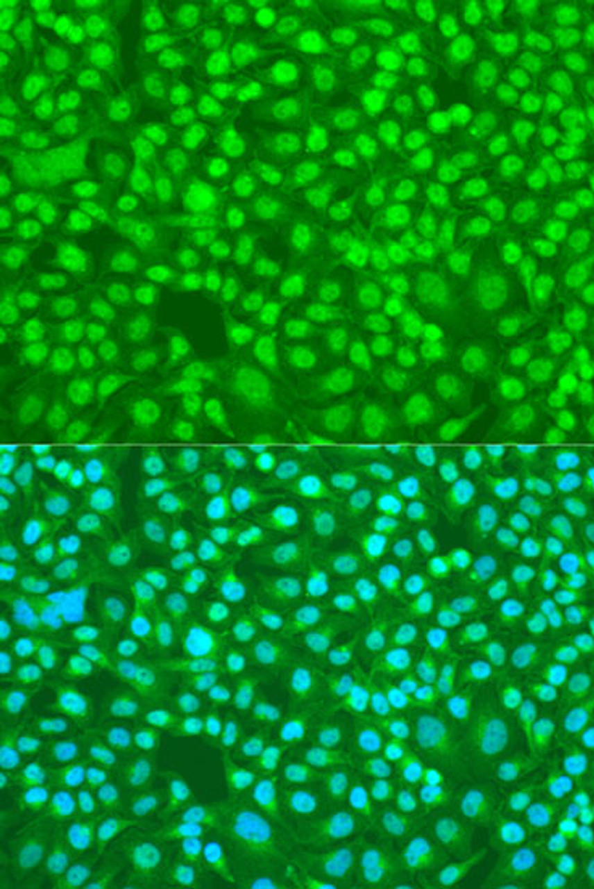 Immunofluorescence analysis of U2OS cells using SFRS9 Polyclonal Antibody at dilution of  1:100. Blue: DAPI for nuclear staining.