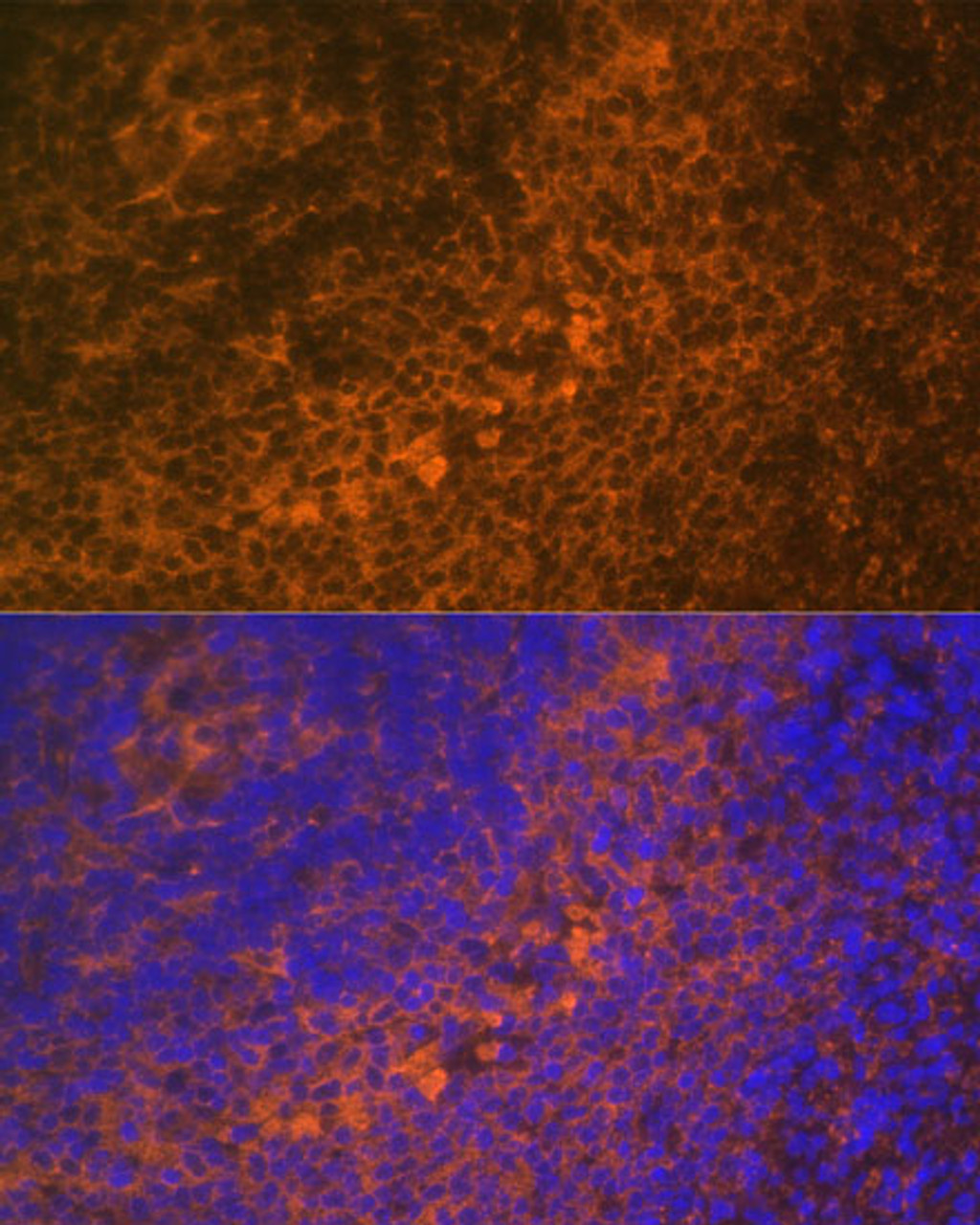 Immunofluorescence analysis of Rat spleen using TNFRSF10A Polyclonal Antibody at dilution of  1:100 (40x lens). Blue: DAPI for nuclear staining.