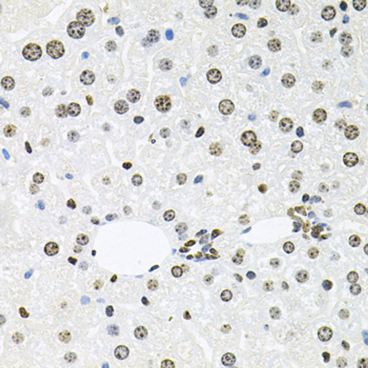Immunohistochemistry of paraffin-embedded Mouse liver using HDAC3 Polyclonal Antibody at dilution of  1:100 (40x lens).