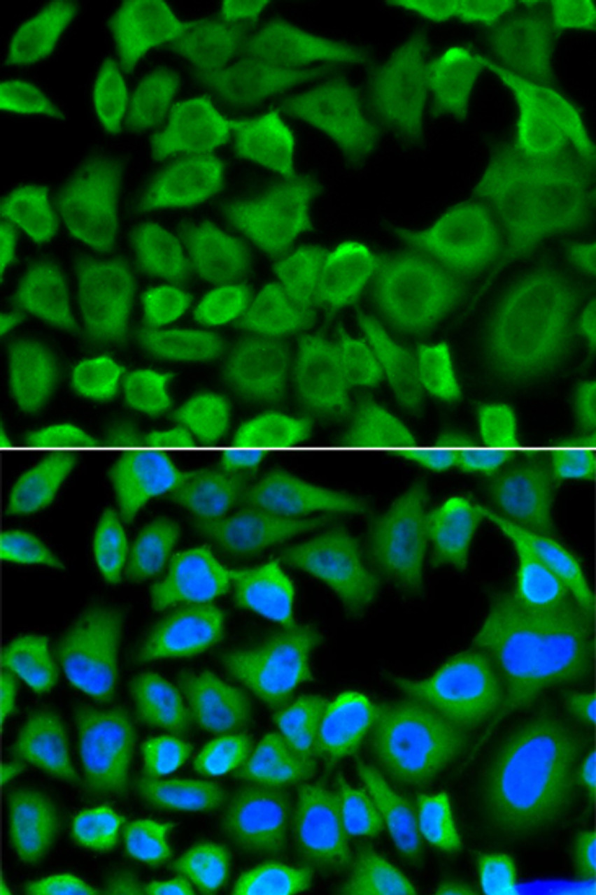 Immunofluorescence analysis of HeLa cells using Bim Polyclonal Antibody